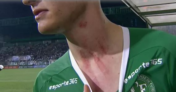 Video: cầu thủ Brazil “tung cước” in dấu giày trên cổ đối thủ